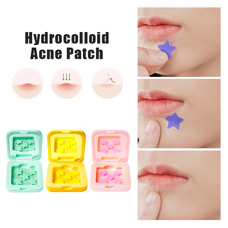 1박스 하이드로콜로이드 여드름 패치 페이드 리페어 보이 - Pressed Powder Foundation 리뷰 및 가격